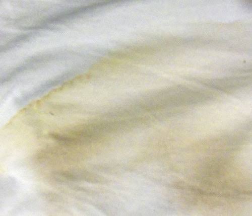 Brightening & discoloration re